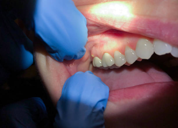 Best Cracked Tooth Emergency Dentist  in Parsons, WV